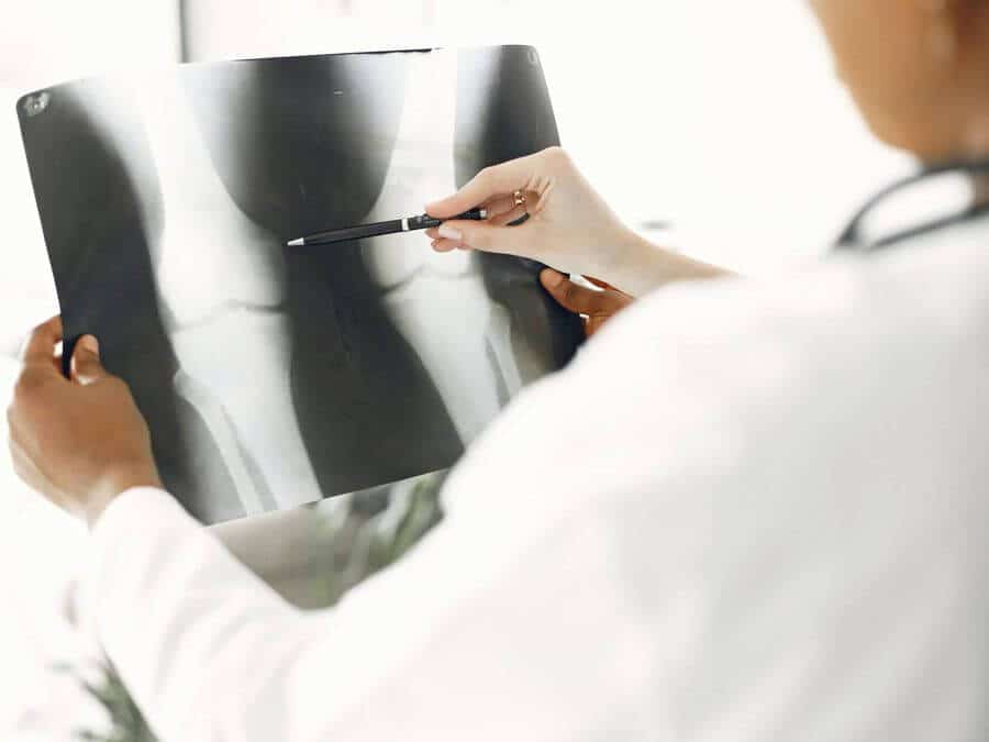 Pozitivní účinky fotobiomodulace při regeneraci kostí dokládá systematický přehled